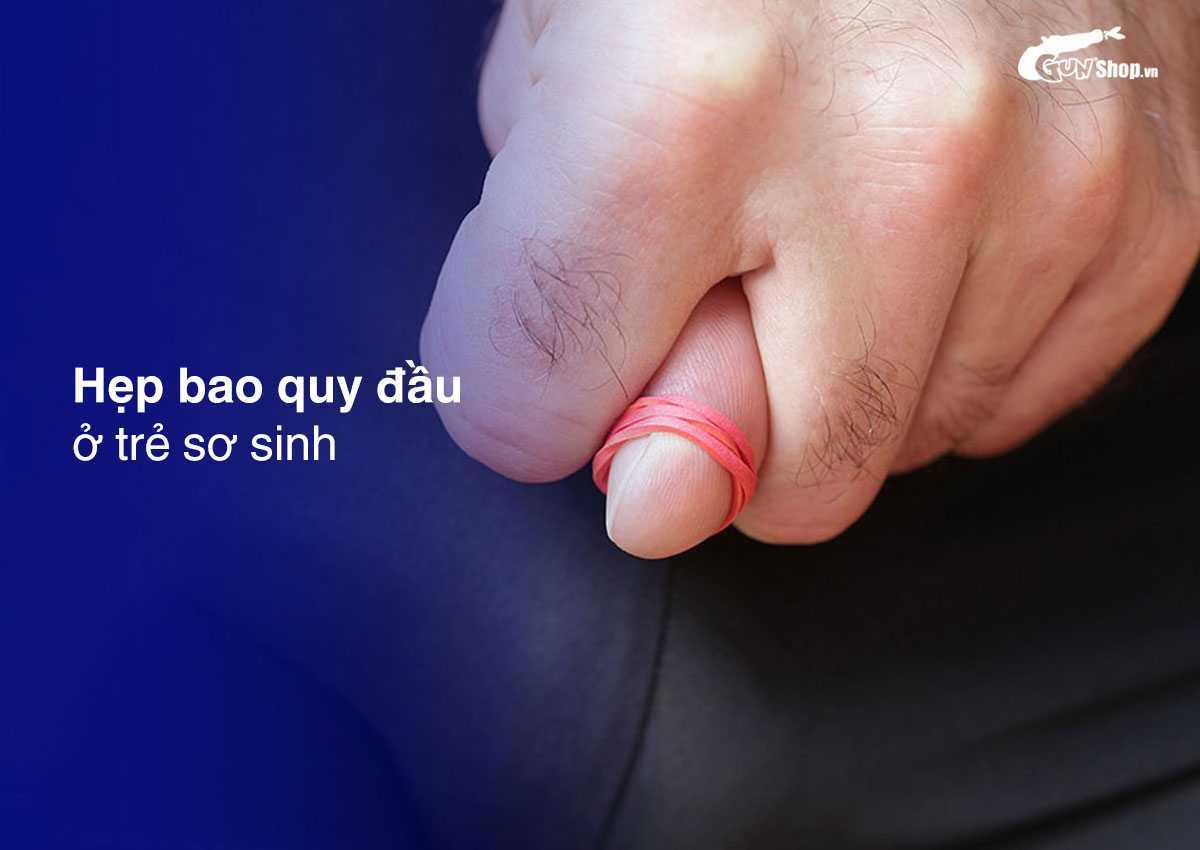 Hẹp bao quy đầu ở trẻ sơ sinh là gì?