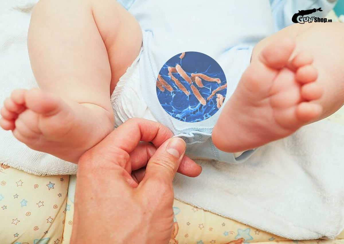 Hẹp bao quy đầu ở trẻ sơ sinh là gì?