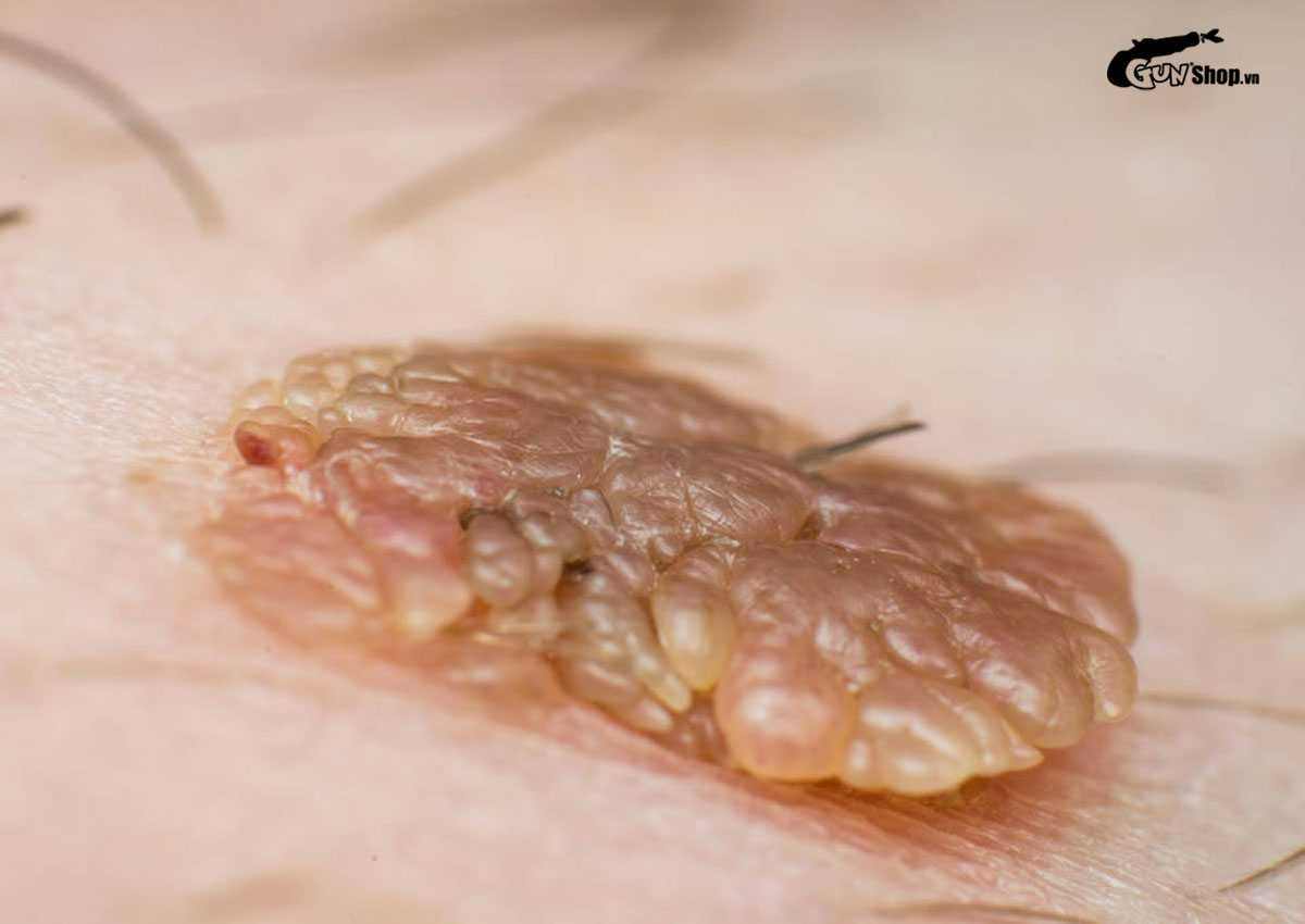 Sau khi quan hệ nên vệ sinh như thế nào để bảo vệ vùng kín?