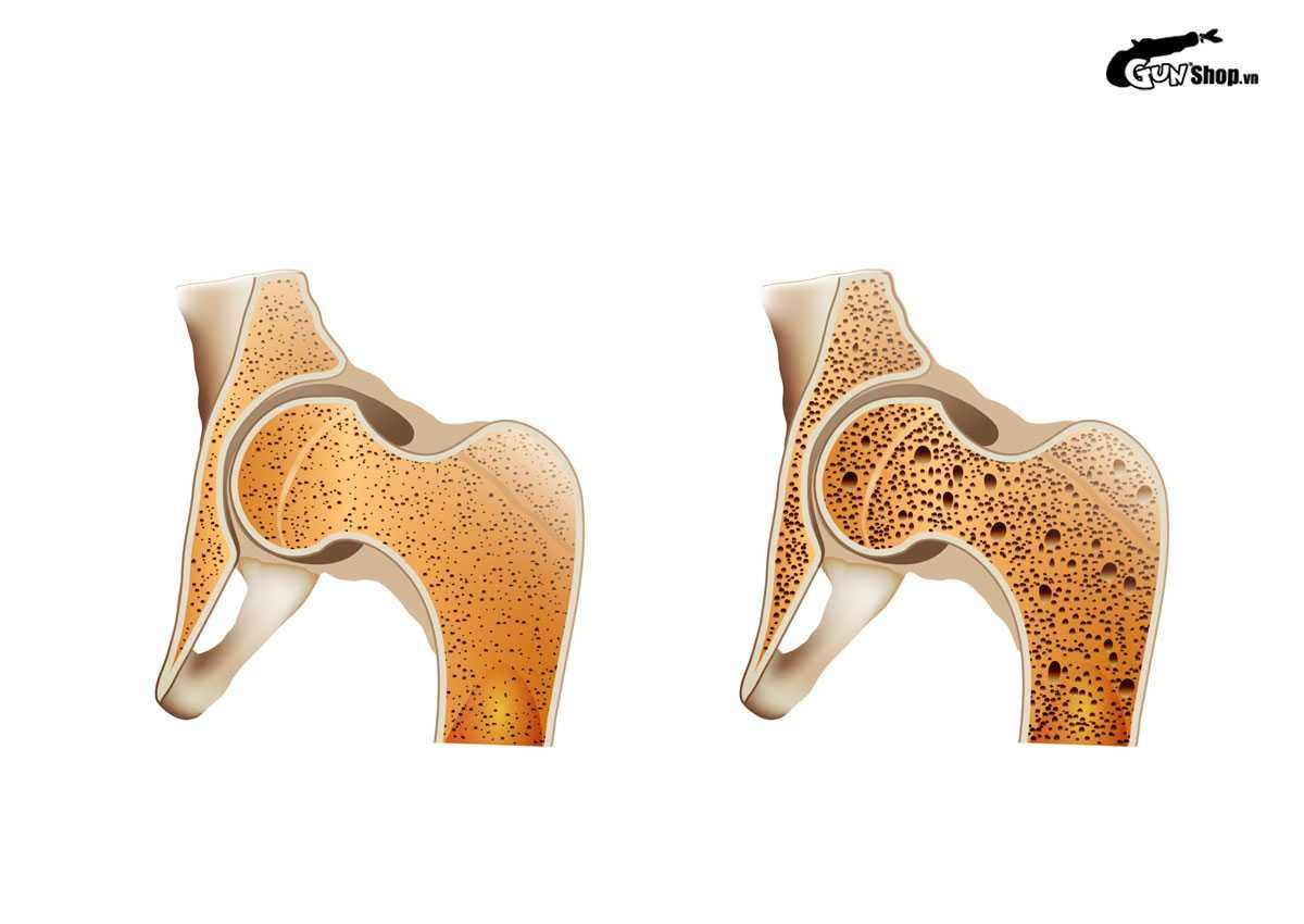 Mất kinh nguyệt 1 năm có sao không? Có nguy hiểm không?