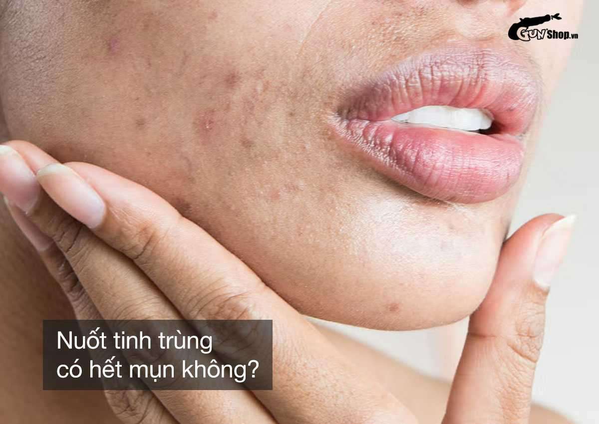 Nuốt tinh trùng có hết mụn không?