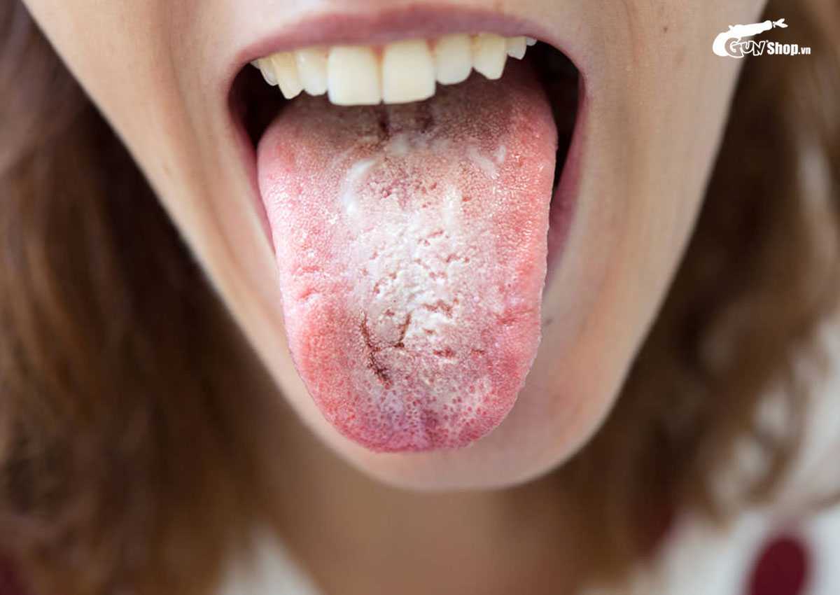 Oral sex là gì?