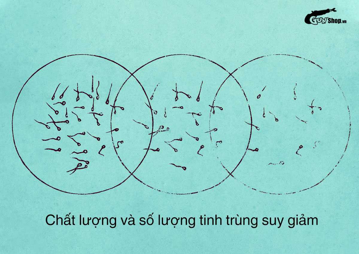 Tinh hoàn xệ có bị vô sinh không?