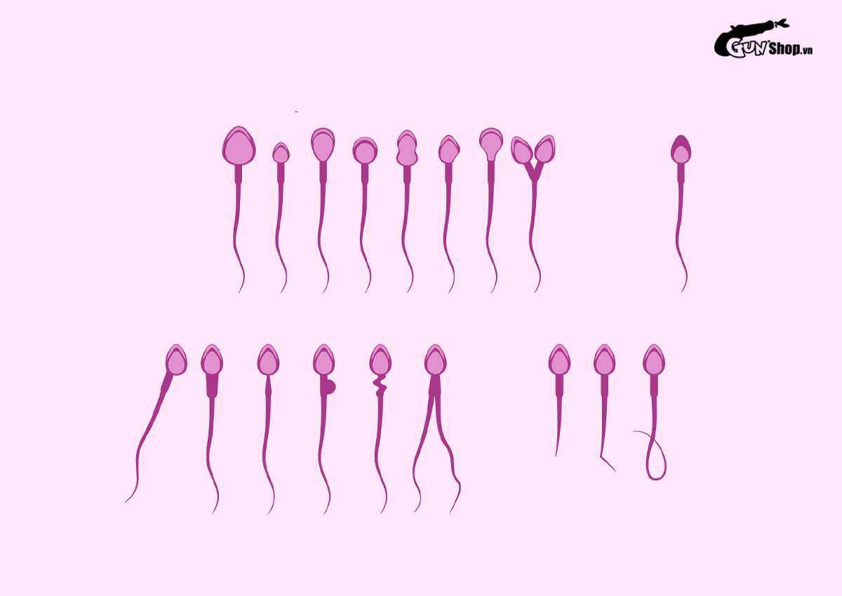 Tinh trùng màu gì thì bị vô sinh? Vô sinh có tinh trùng không?