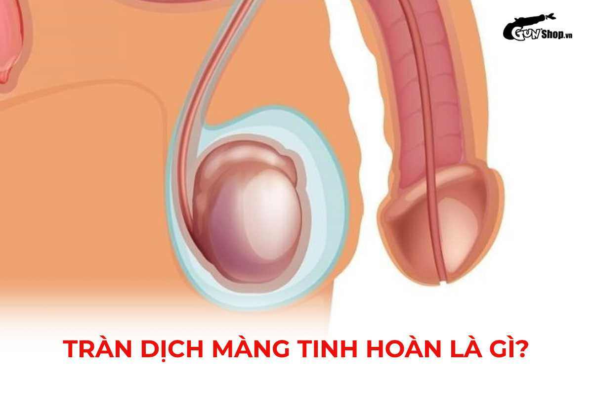 Tràn dịch màng tinh hoàn là gì? Có nguy hiểm không? Cách điều trị