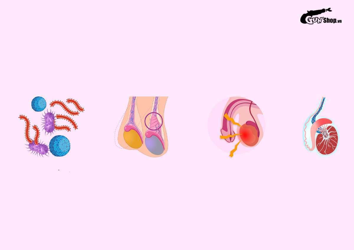 Tràn dịch màng tinh hoàn là gì? Có nguy hiểm không? Cách điều trị