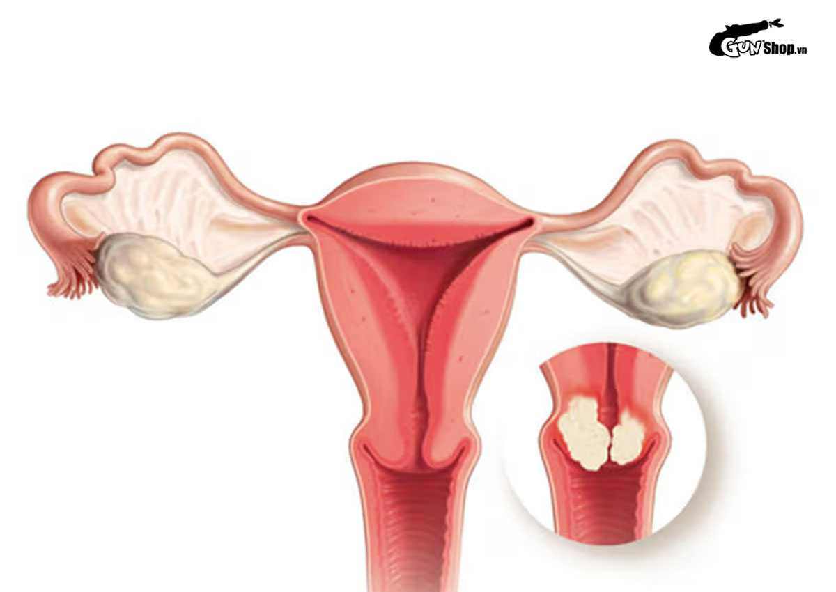 Dùng dầu ăn để bôi trơn khi quan hệ có an toàn không?