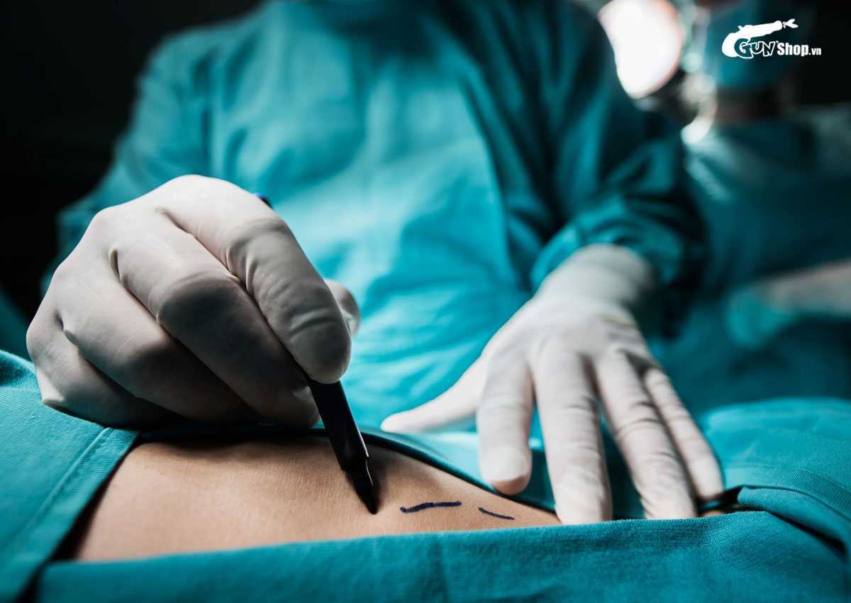 Trong điều trị yếu sinh lý, phẫu thuật chỉ được cân nhắc khi thuốc và vật lý trị liệu không đạt kết quả mong muốn