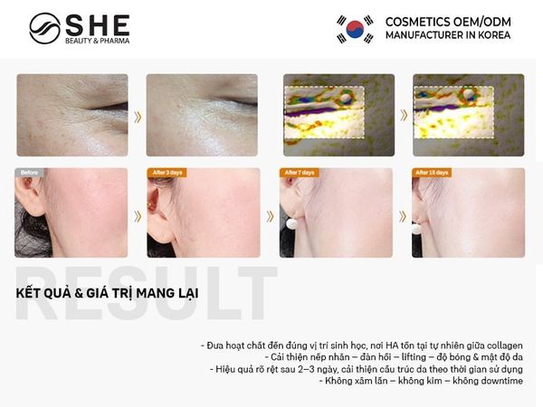 công nghệ thẩm thấu dermi shuttle 3