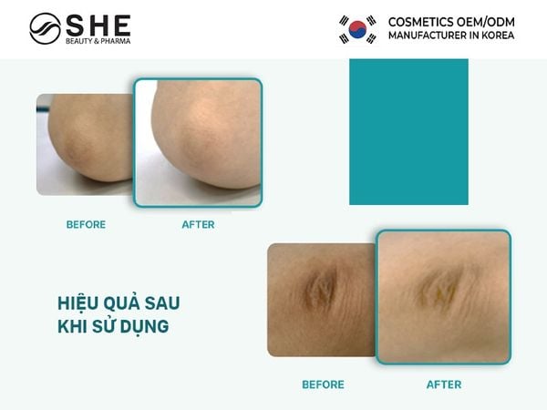 sản xuất tẩy da chết 3