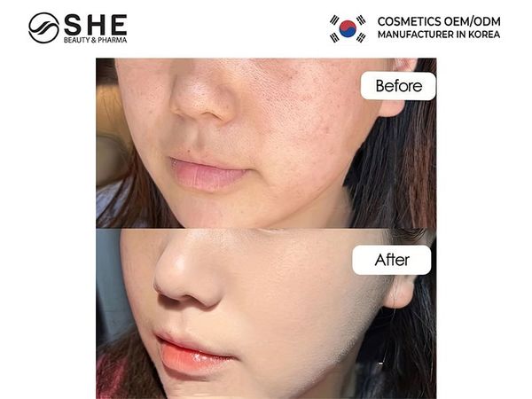 Công Nghệ Peptide MelaTrepein™
