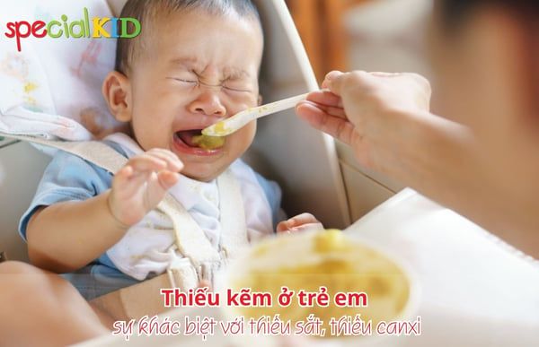 Thiếu kẽm ở trẻ khác với thiếu canxi và sắt