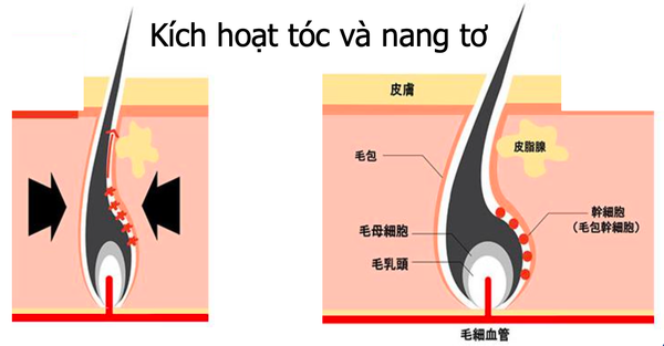 Ứng dụng trong dầu gội tại Trung Quốc