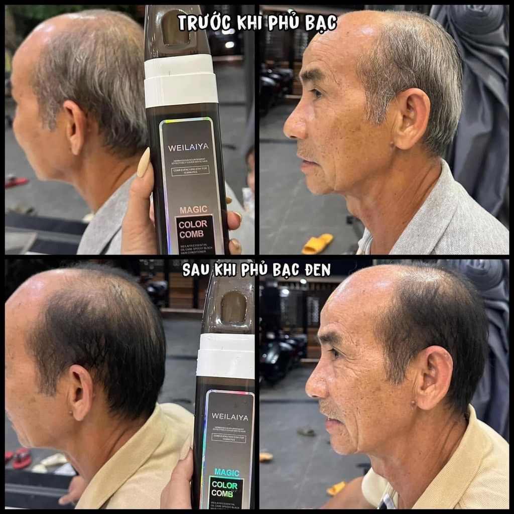 Người lớn tuổi sử dụng dầu gội phủ bạc của Weilaiya