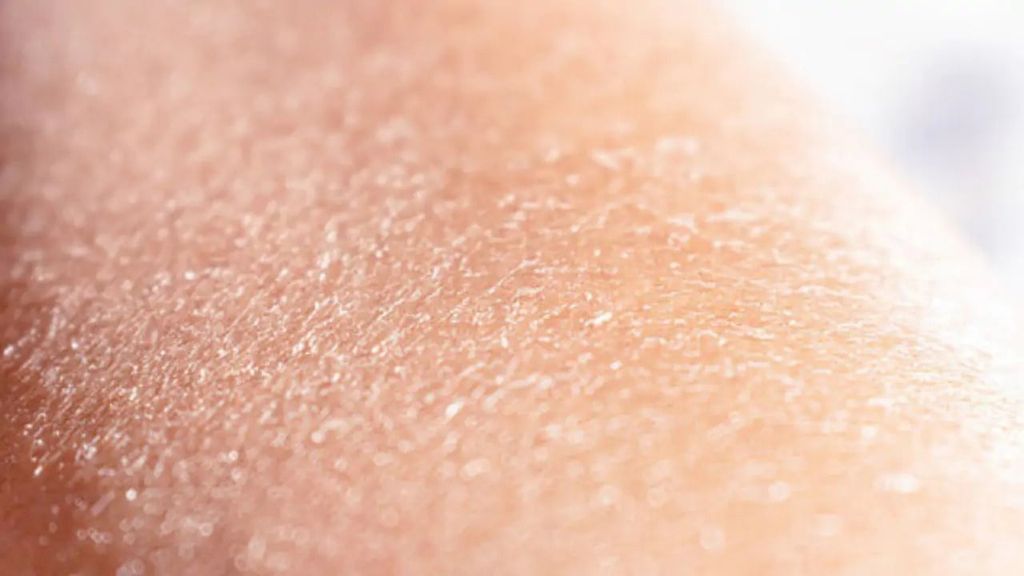 Da bong tróc, nứt nẻ là dấu hiệu của việc bị khô, mất nước trầm trọng