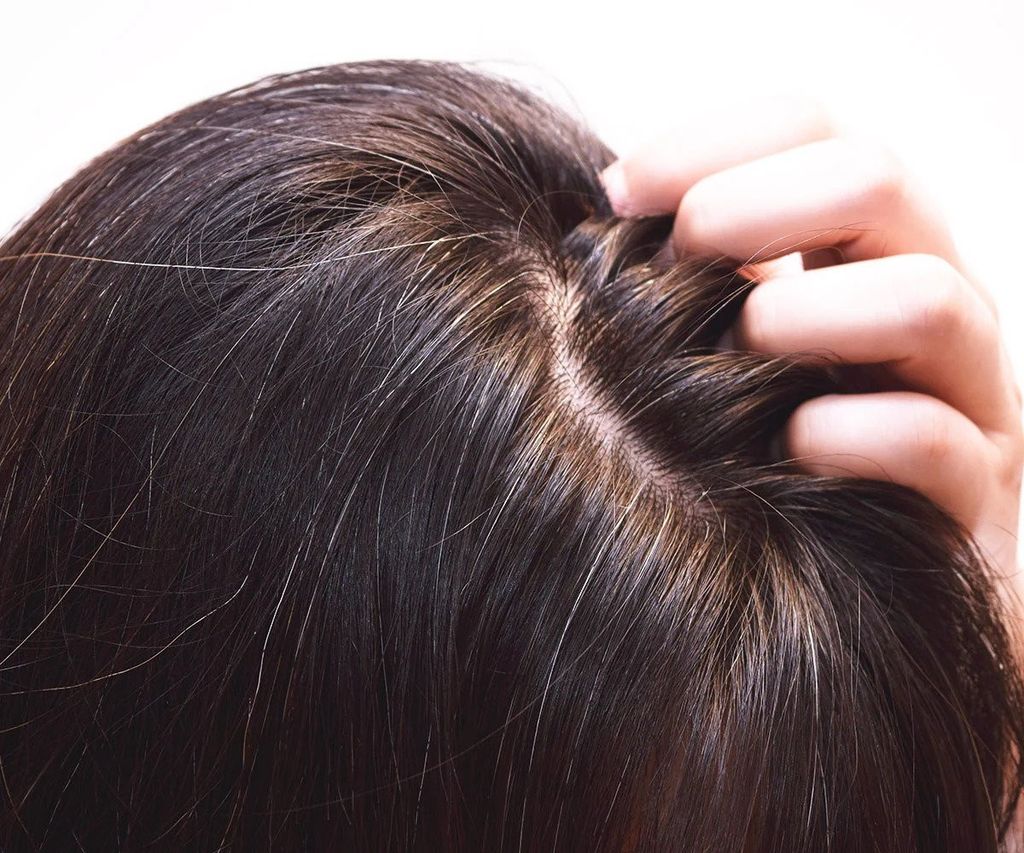 Làm sao để cải thiện tình trạng tóc bạc sau sinh?