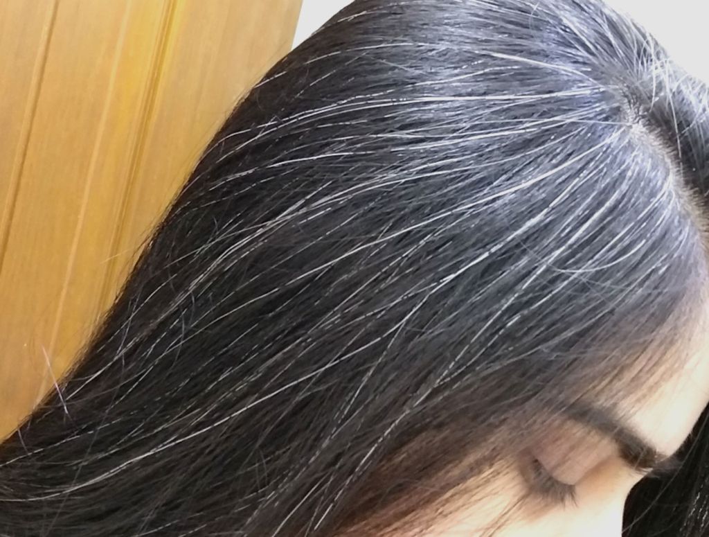 Tại sao nhiều người bị tình trạng tóc bạc sớm?