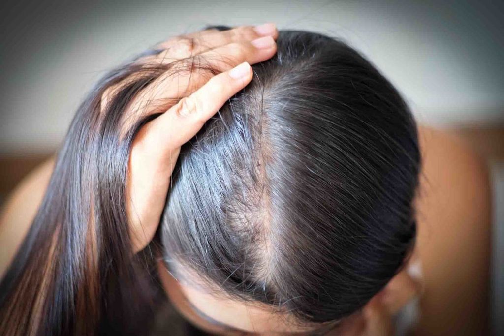 Tóc rụng, thưa, bạc sớm, xơ rối là tình trạng nhiều người gặp phải