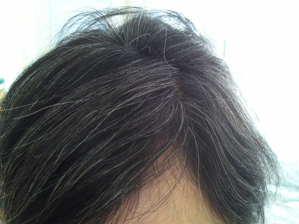 Nhiều người bị tóc bạc sớm dù còn ít tuổi