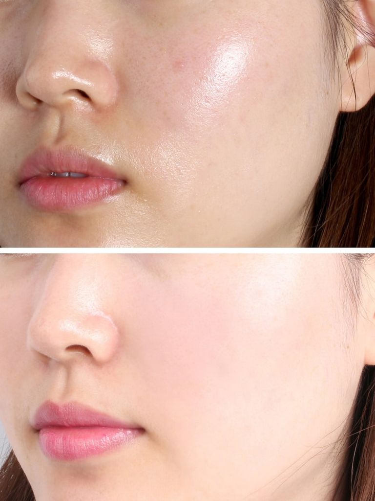 Làm thế nào để da mặt bớt dầu nhờn?