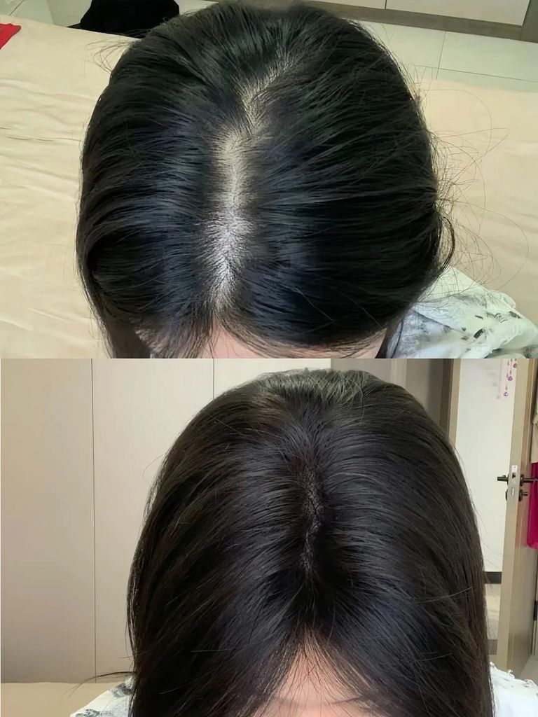 Tóc trước và sau khi kiên trì sử dụng các biện pháp chăm sóc tóc đúng cách