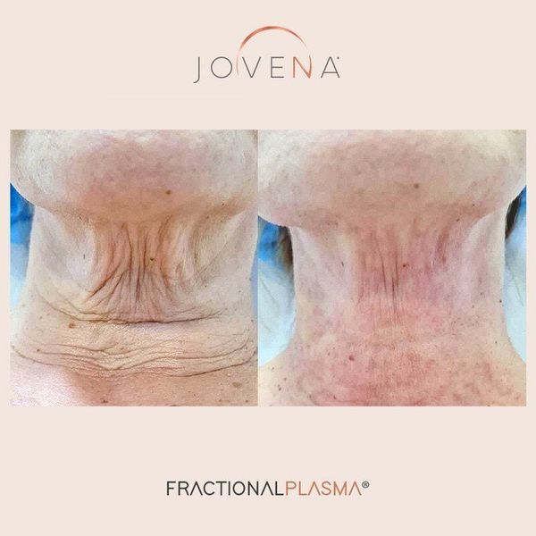 da-mat-chay-xe-phai-lam-sao-2