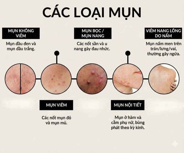 cach-tri-mun