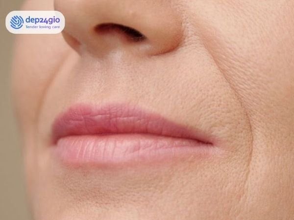 Da mặt phụ nữ trung niên xuất hiện nếp nhăn và chảy xệ do lão hóa sau 40 tuổi