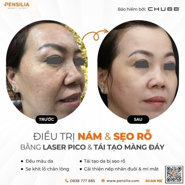 phuong-phap-dieu-tri-nam-truoc-sau