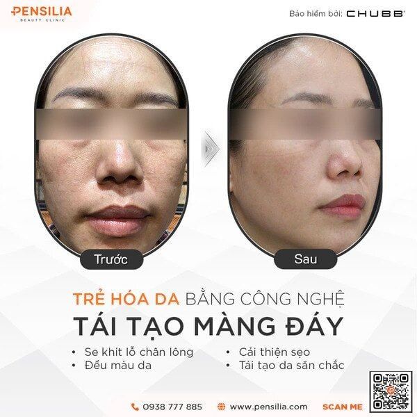 tang-sinh-collagen-truoc-sau