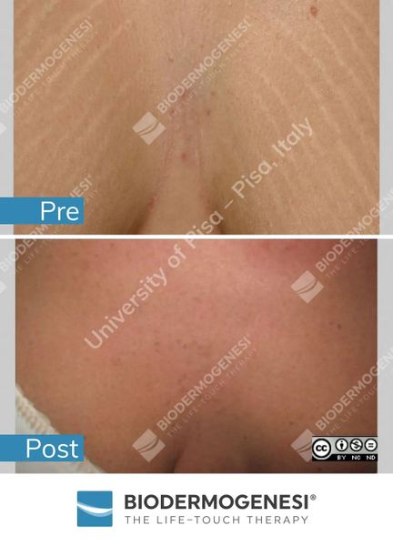 tri-ran-da-lau-nam-2