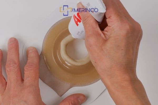 Sử dụng đế lồi hậu môn nhân tạo thì dán kem chống xì lên mặt nào?