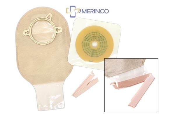 Túi hậu môn nhân tạo loại kẹp rời hay loại dán tốt hơn?