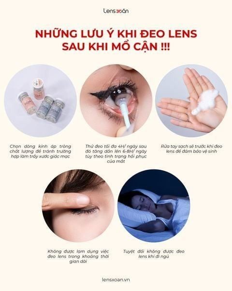 Cách tháo kính áp tròng bị kẹt trong mắt an toàn