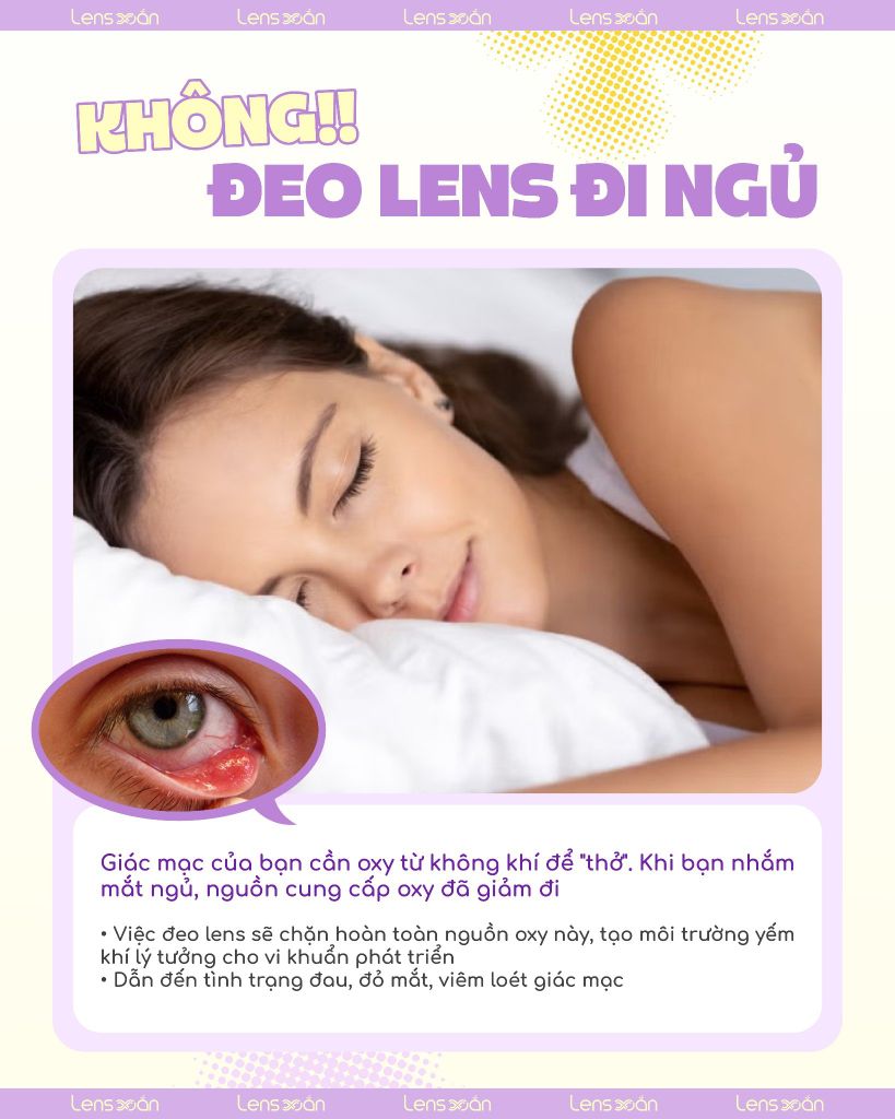 KHÔNG đeo lens đi ngủ – Bảo vệ mắt an toàn từ Lens Xoắn
