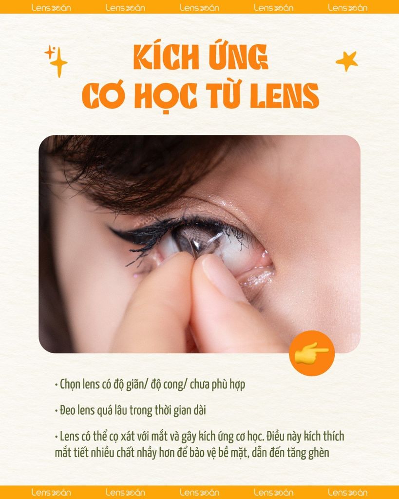Vì sao đeo lens mắt đổ ghèn nhiều – Nguyên nhân phổ biến & cách xử lý an toàn