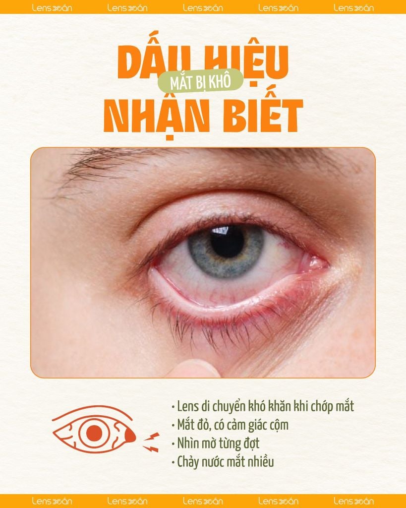 Mẹo tháo lens khi lens dính chặt vào mắt an toàn