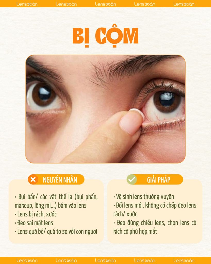 Những vấn đề thường gặp khi newbie mới đeo lens và cách xử lý an toàn