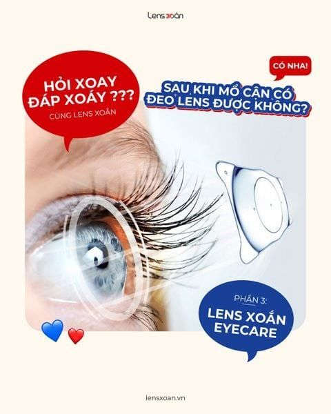 Cách tháo kính áp tròng bị kẹt trong mắt an toàn