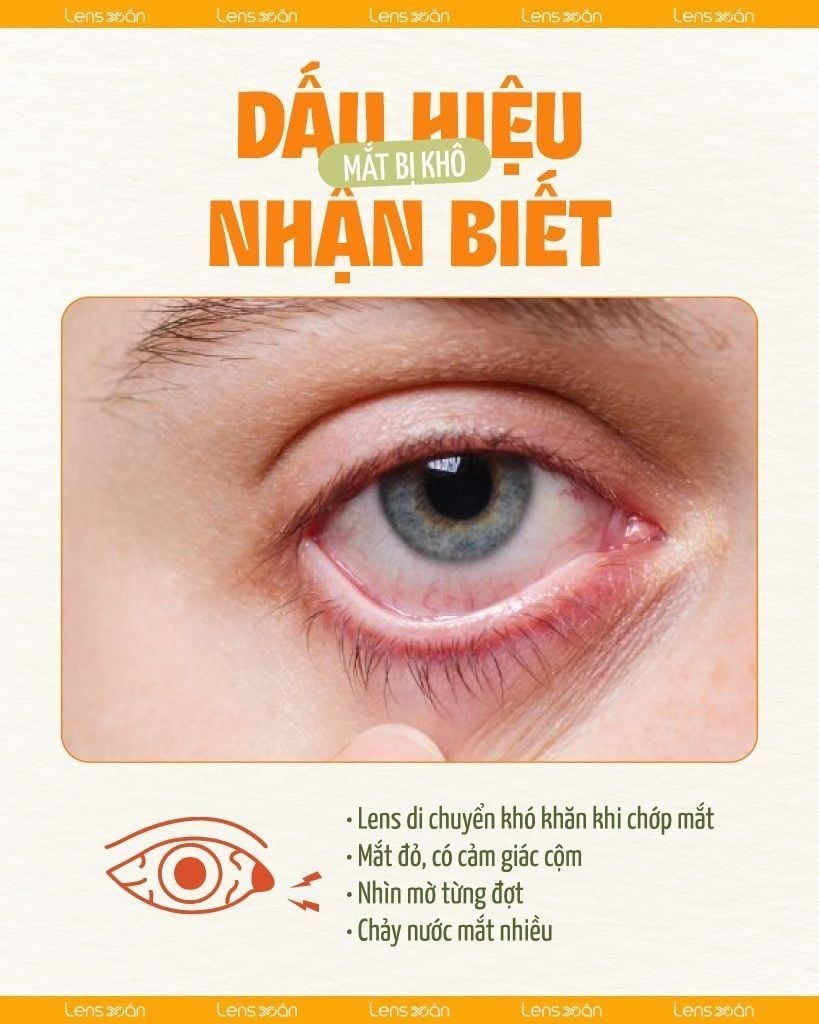 Hướng dẫn cách tháo lens ra khỏi mắt đúng cách an toàn và đơn giản