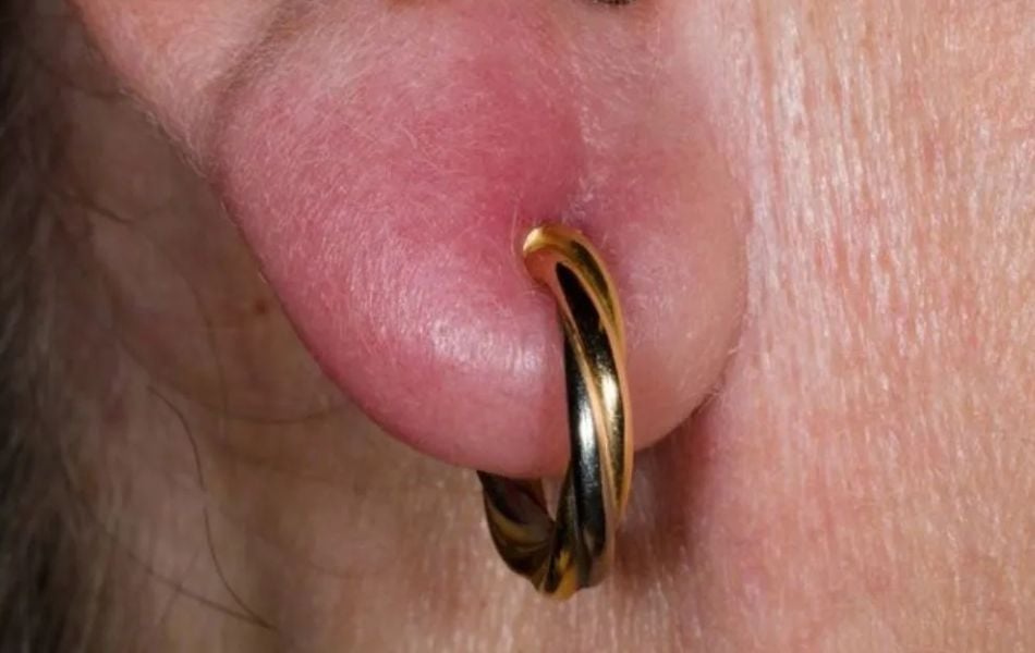 cách tháo bông tai tròn