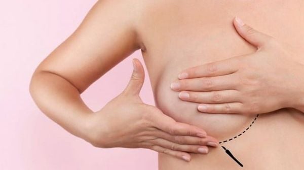 Kỹ thuật massage ngực cổ truyền