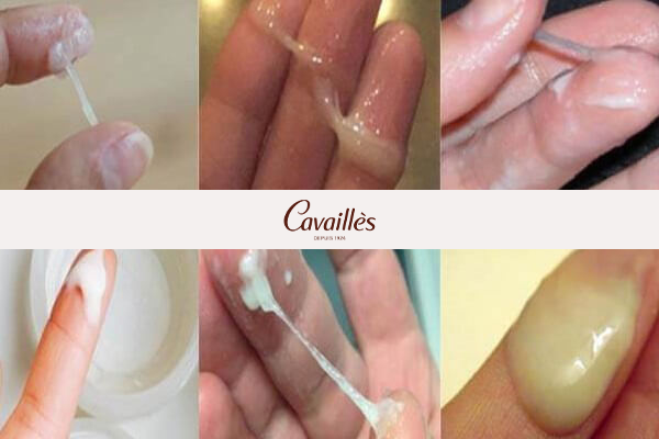 Các dạng khí hư màu trắng thường gặp và ý nghĩa