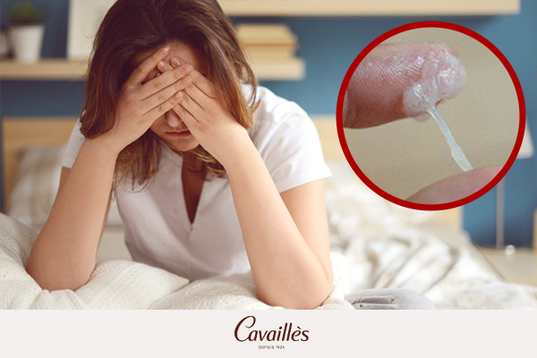 Khi nào khí hư màu trắng là dấu hiệu bệnh lý?