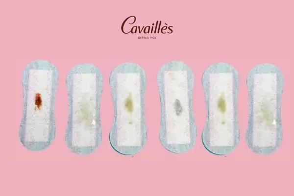 Nguyên nhân gây ngứa vùng kín kèm dịch bất thường