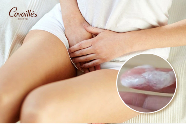 Ngứa vùng kín kèm dịch bất thường có nguy hiểm không?