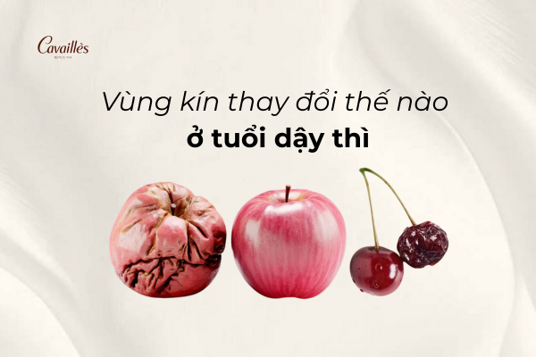 Vùng kín thay đổi thế nào ở tuổi dậy thì?