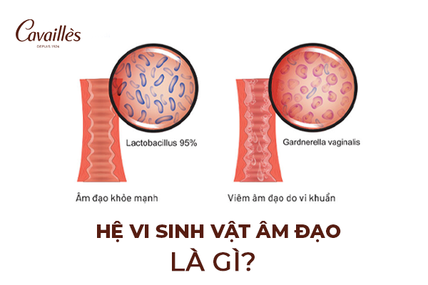 Hệ vi sinh vật âm đạo là gì