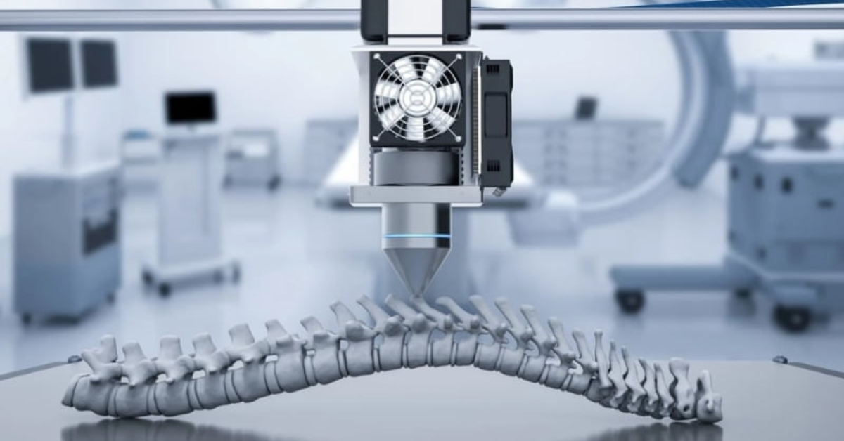 Ép đùn là gì? Công nghệ, ứng dụng, so sánh và lỗi thường gặp