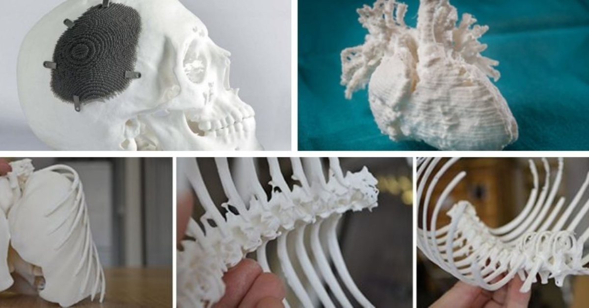 Scan 3D Là Gì? Các Công Nghệ Quét 3D Phổ Biến & Ứng Dụng Thực Tế